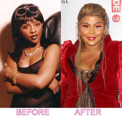 lil-kim-before-after-plastic-surgery